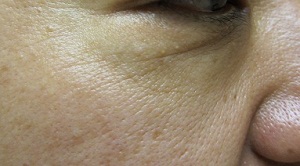oxygen before